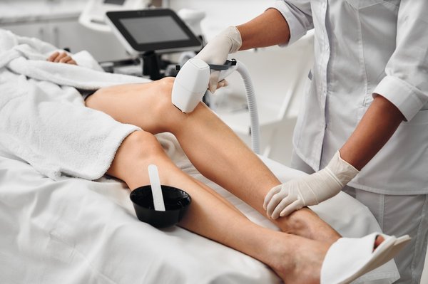 Épilation définitive à caen : la technologie au service de votre peau